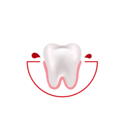 Hvor ofte oppplever du blødning når du pusser tennene eller bruker tanntråd?