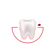 Hvor ofte oppplever du blødning når du pusser tennene eller bruker tanntråd?