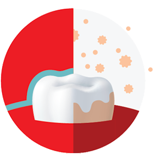 Cavity prevention 