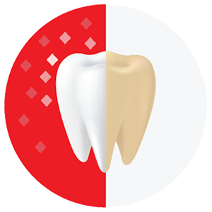 Teeth whitening 